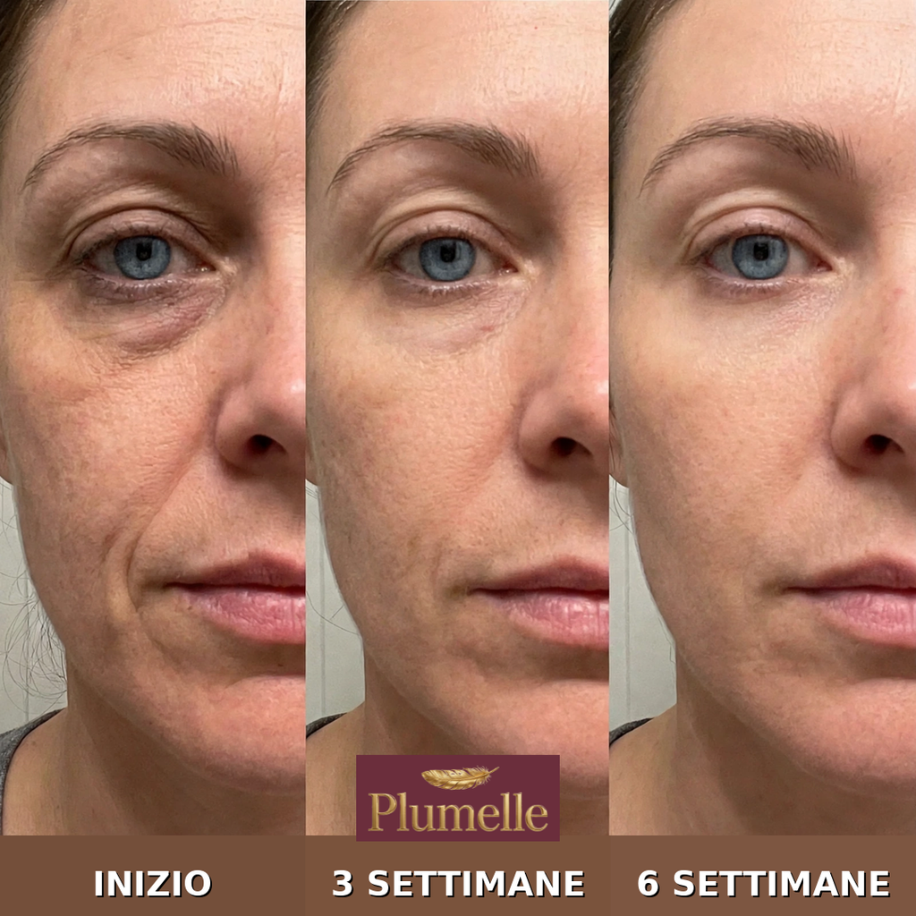 PLUMELLE® VOLUMÈRE 6 – PDRN + 5% VOLUFILINE Multi-Density Genesis Balm